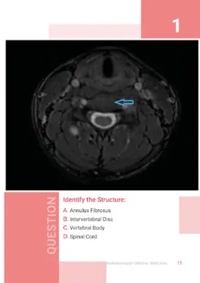 MRI Spine android App screenshot 1